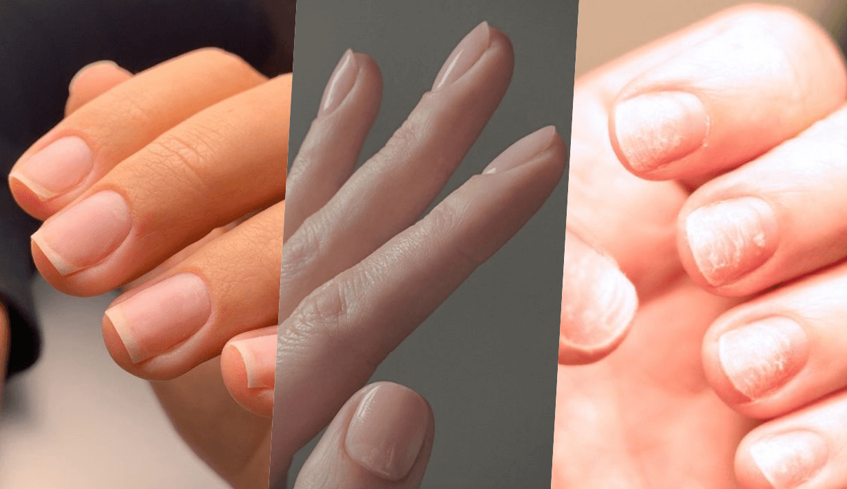 should we take a break from nail polish 