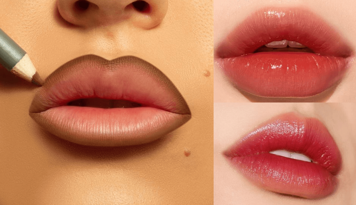 lip contouring